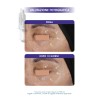 MIAMO PROTOCOLLO FILL & LIFT RUGHE DI TONO